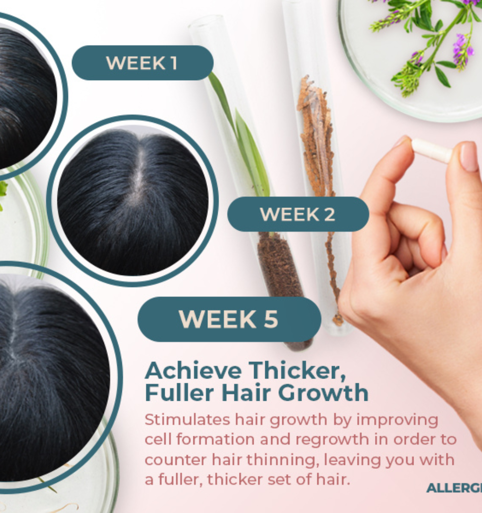 Vital Hair Complex Hair.